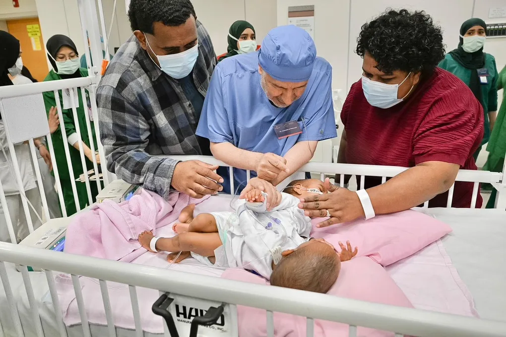 Saudi doctors begin separation surgery on Fijian conjoined twins